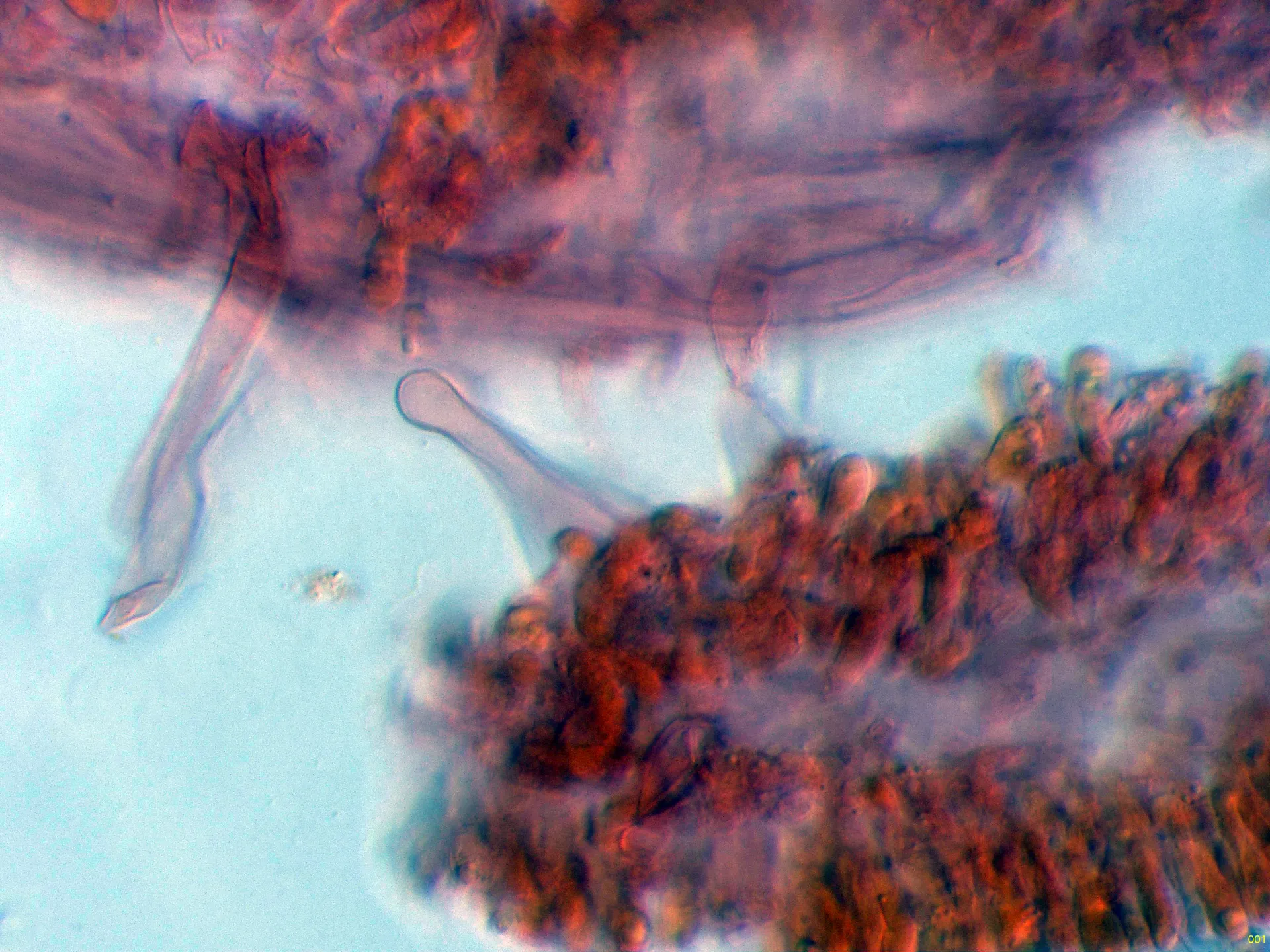 Microscopía de Rickenella swartzii - 10 - Caulocistidio-001